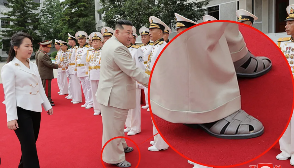 “중국 방문한 김정은은 대역... 김정은 사망 확실”