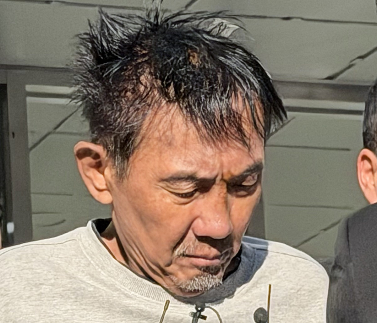 '인천 칼부림' 최충락 자해행위, 이마 다쳐…병원 긴급이송