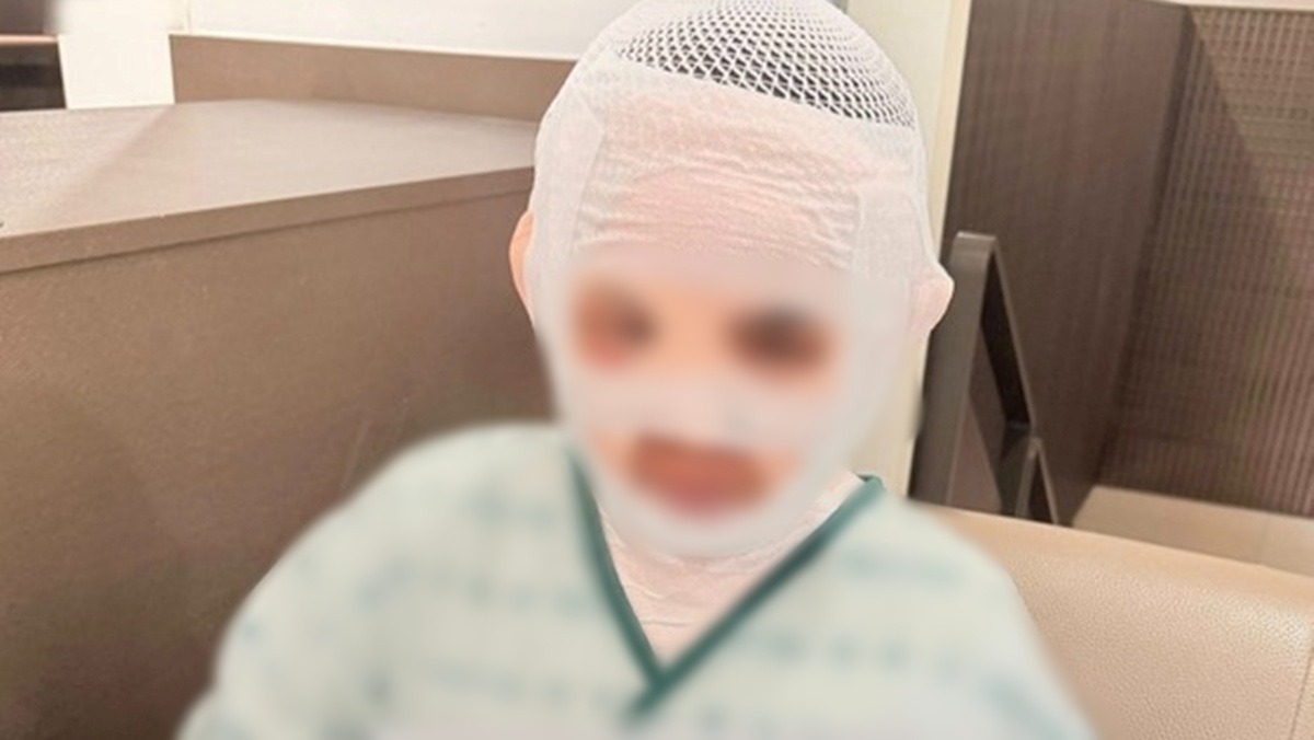 태국인 아내 얼굴에 끓는 물 부은 남편… 항소심서 감형, 왜?